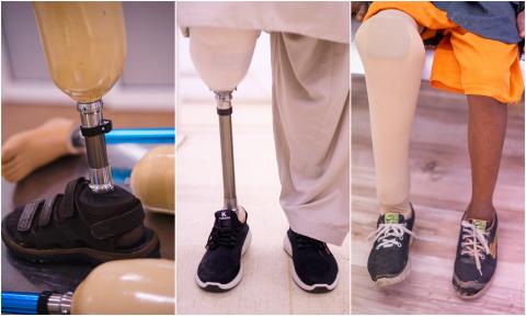 Prosthetics Image